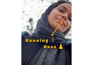 آبریزش بینی به انگلیسی - معنی running nose به فارسی